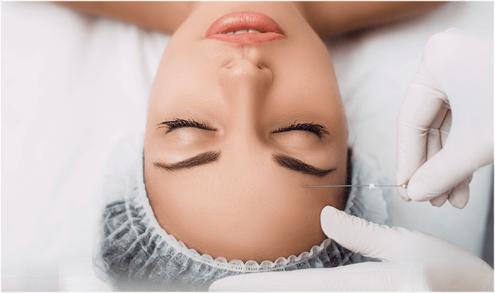Thread Lift Procedures Toronto & Mississauga